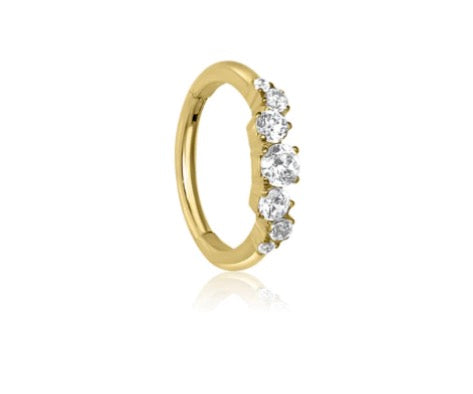 Astra cartilage hoop